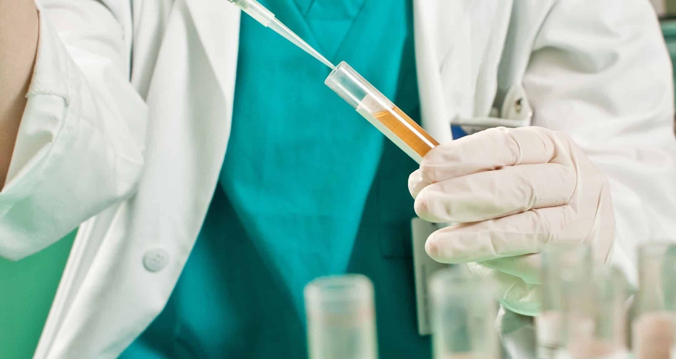 PCR Molecuar Testing